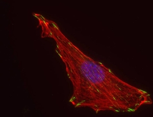 Microscopic image of a cell with red actin filaments, a central blue nucleus, and green vinculin containing focal adhesions.